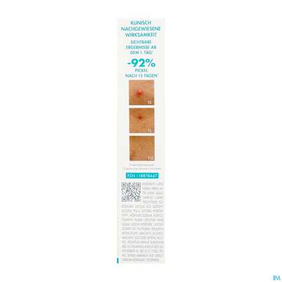 Sie sehen eine Packung Avene Cleanance Comedomed Intensiv Anti-pickel Akutpflege 40ml, Produktbild: 07 Avene Cleanance Comedomed Intensiv Anti-pickel Akutpflege 40ml, A-Nr.: 5899040 - 07