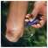 Insektenschutz Para Kito Nach Stich Roll-on 5ml, A-Nr.: 4835954 - 12